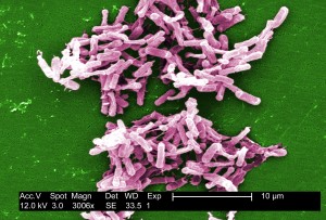 Img 003 Clostridium difficile